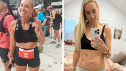 Millennial With Bowel Cancer Has Important Message for Parents