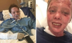 Gen Z Woman Survives Gas Explosion, Then She Shares Update 6 Years Later