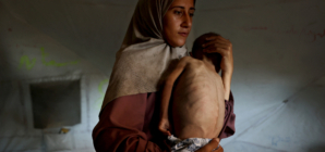 How a Viral Image Is Fueling the Fight over Reports of Starvation in Gaza