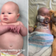 Baby Has Swollen Feet, Then Parents Told Devastating Reason