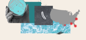 Why Fatal ‘Flesh-Eating’ Bacteria Infections Are On The Rise