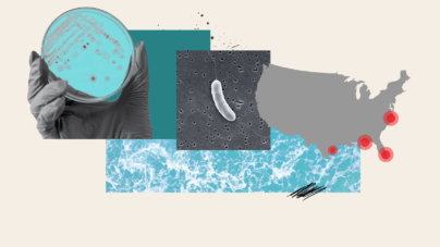 Why Fatal ‘Flesh-Eating’ Bacteria Infections Are On The Rise