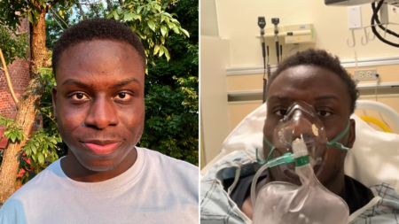 Man, 24, Thought His Chest Pain Was Work Stress, Then Gets Shock Diagnosis
