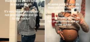 Teen Looks Heavily Pregnant, Shock Over What She’s Actually Growing