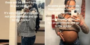 Teen Looks Heavily Pregnant, Shock Over What She’s Actually Growing