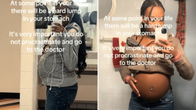 Teen Looks Heavily Pregnant, Shock Over What She’s Actually Growing
