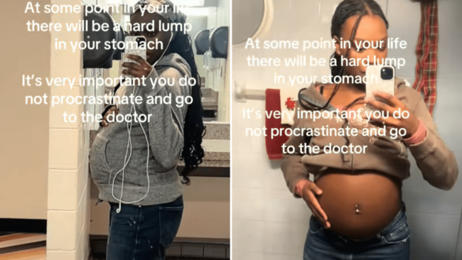 Teen Looks Heavily Pregnant, Shock Over What She’s Actually Growing