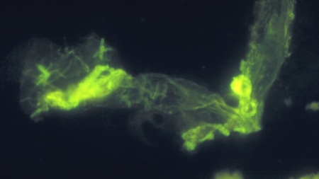 Over a Dozen Cases of Legionnaires’ Disease Possibly Linked to Florida Gym