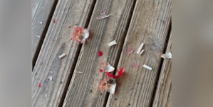 Grandma Breaks Decades Old Christmas Ornament—Shock at What’s Hidden Inside