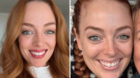 I Thought I Had a Pimple on My Nose, but It Changed My Life Forever