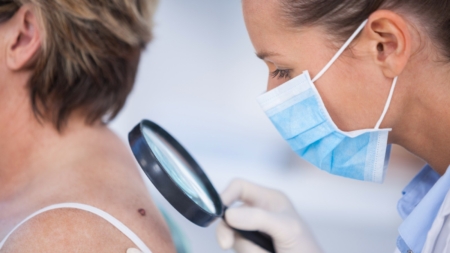 Woman Thought It Was A Beauty Mark—Until Diagnosis Changed Everything