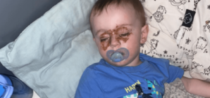 Mom Checking on Toddler at Night Spots Strange Marks on Eyes—Then Realizes