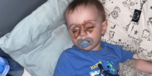 Mom Checking on Toddler at Night Spots Strange Marks on Eyes—Then Realizes