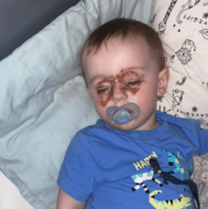 Mom Checking on Toddler at Night Spots Strange Marks on Eyes—Then Realizes