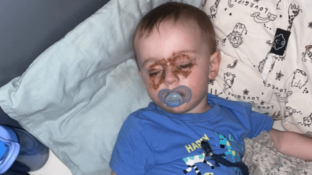 Mom Checking on Toddler at Night Spots Strange Marks on Eyes—Then Realizes