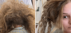 Woman Wakes Up in ICU After 5 Days, Then She Sees Photo She’ll Never Forget