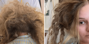 Woman Wakes Up in ICU After 5 Days, Then She Sees Photo She’ll Never Forget